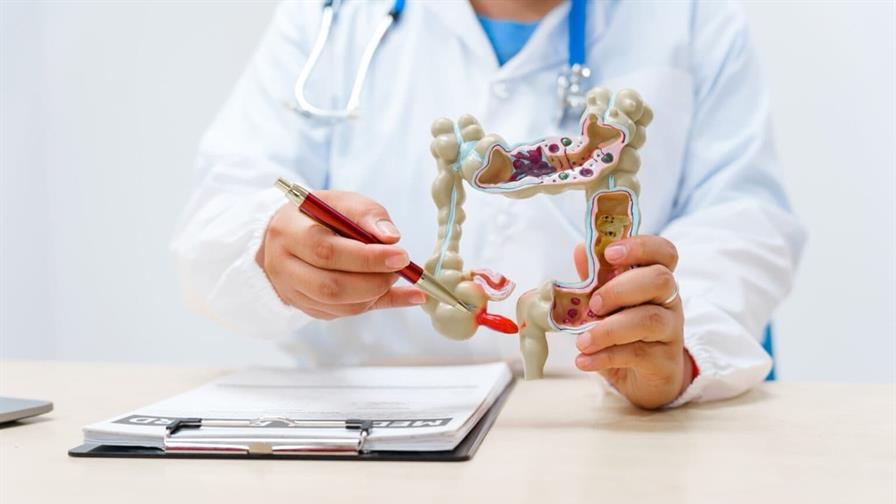 El cáncer de colon es una enfermedad silenciosa que, muchas veces, puede prevenirse