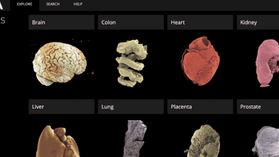 El «google earth» de los órganos permite una perspectiva inigualable del cuerpo humano